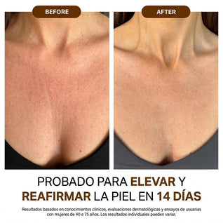 Anti-Cellulite® | Aceite de Masaje Natural MX (100ml)