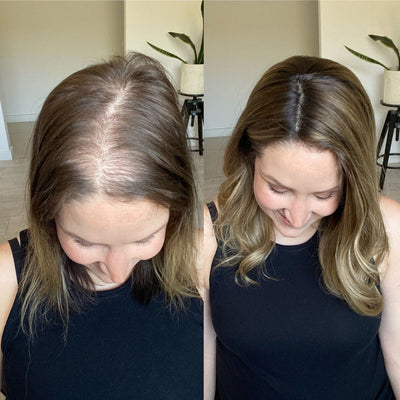 Tratamiento K-24® | Fórmula completa para detener la caída del cabello
