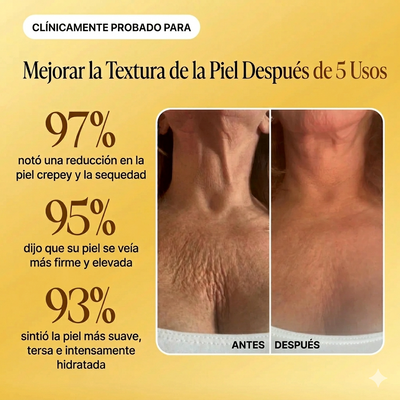 Anti-Cellulite® | Aceite de Masaje Natural MX (100ml)