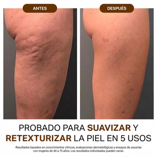 Anti-Cellulite® | Aceite de Masaje Natural MX (100ml)