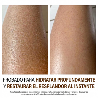Anti-Cellulite® | Aceite de Masaje Natural MX (100ml)
